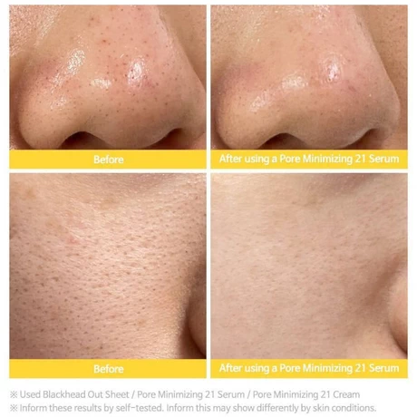 Pore Minimizing 21 Serum 30ml - vista alternativa
