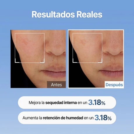 Hyaluronic Acid Skin Booster First Serum 150ml - vista alternativa