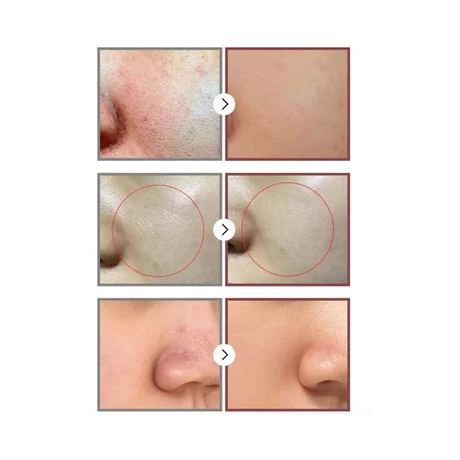 No.3 Tingle Pore Softening Mascarilla de Tela 1ea - vista alternativa